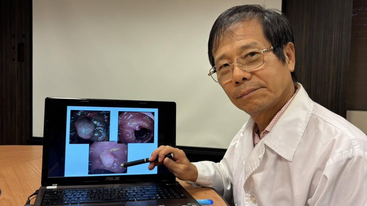 血便以為是痔瘡!連3人切息肉「全驗出大腸癌」 醫曝2類人最危險