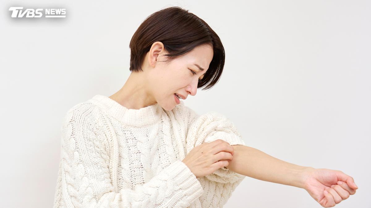 失眠竟讓蕁麻疹又發作?38歲女停藥4年復發 醫點名5種食物少碰