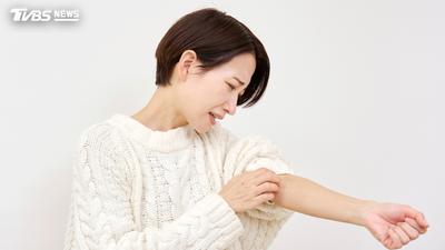 失眠竟讓蕁麻疹又發作?38歲女停藥4年復發 醫點名5種食物少碰
