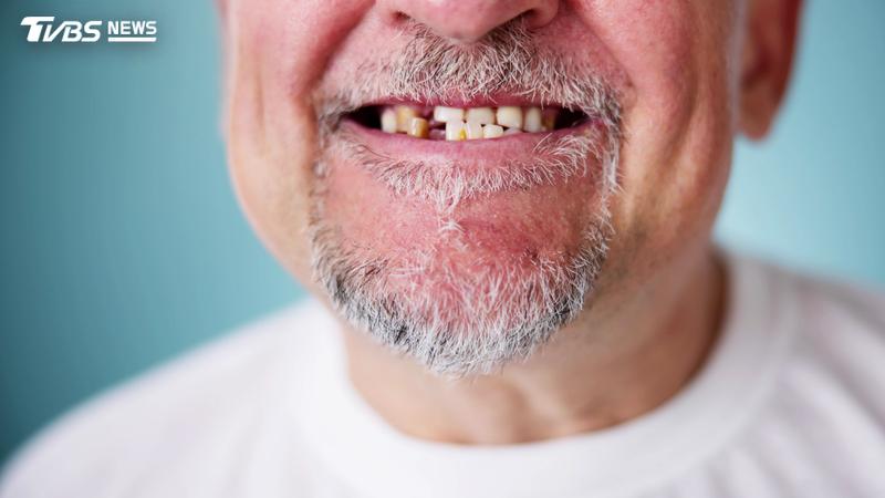 國內65歲以上長者缺牙比例接近9成。(示意圖/Shutterstock達志影像)