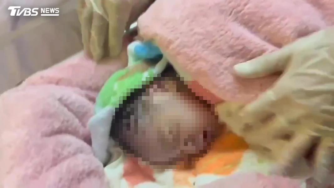 桃園-火災-婦產科-死產-移工-健保詐領-男嬰死產