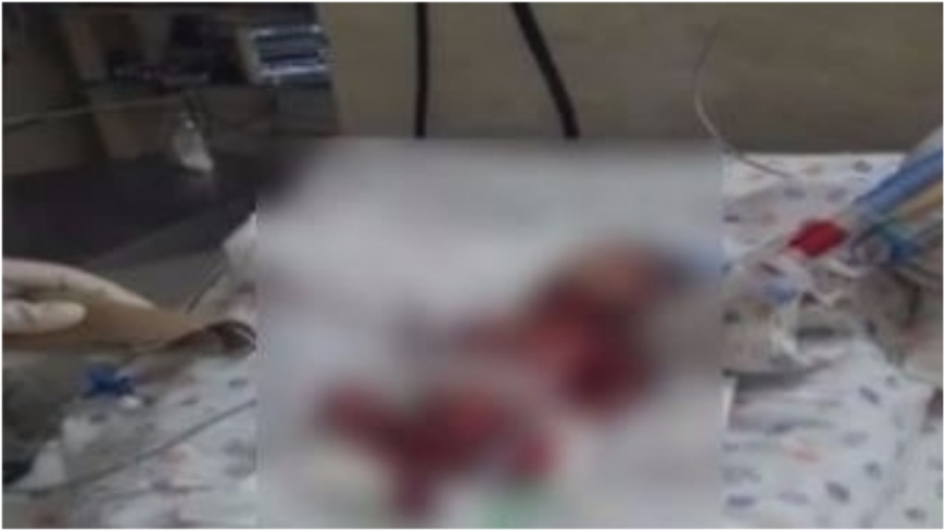 雙胞胎男嬰宣布死亡 火葬前一刻…死而復生!