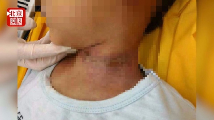 5歲童教室離奇吊頸亡 母控師偽造現場