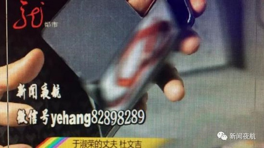 30公分又粗還會動 大媽染怪病小便排出8活蟲