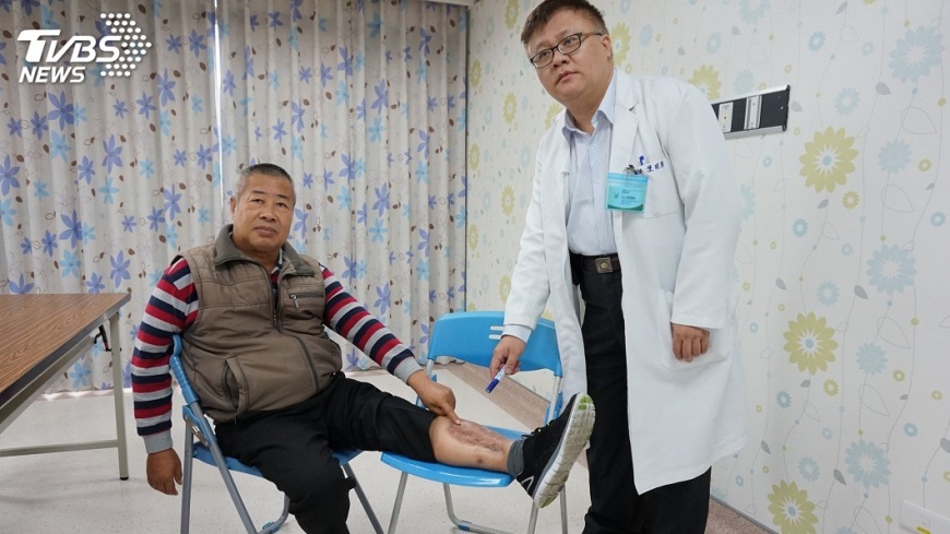 小腿撞傷出現小烏青　糖尿患者險截肢