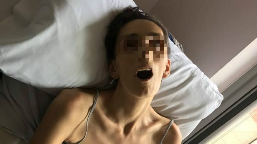 愛妻錯過一次抹片檢查病逝 夫心痛po病容照