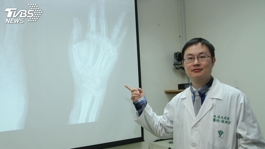 痛風多年缺警覺 男肌腱斷裂拇指失能