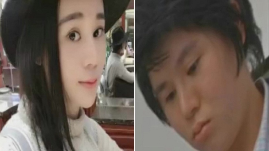 瑜珈正妹「微整形」昏迷 醒來竟失智終身殘疾