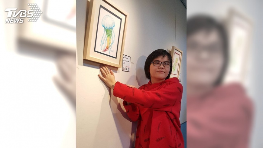 肥胖讓才女畫家手麻 胃袖狀切除術變身