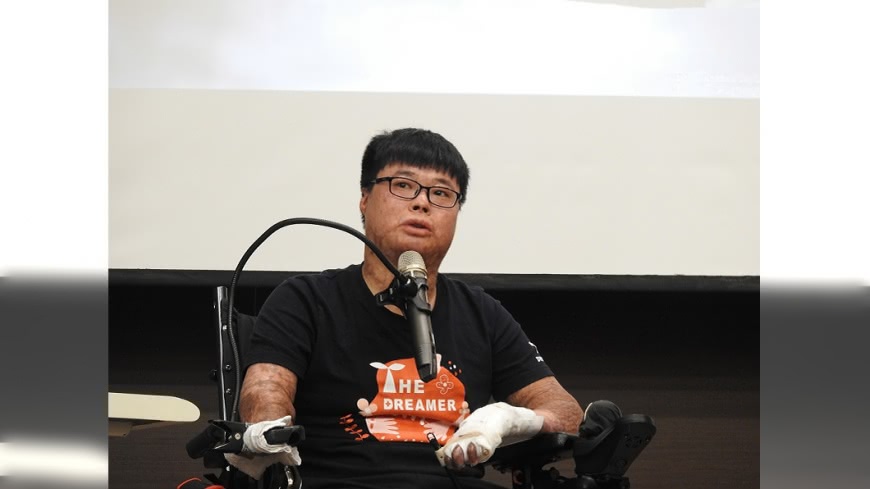 八仙塵爆截肢仍有笑容 黃博煒:都是假裝的