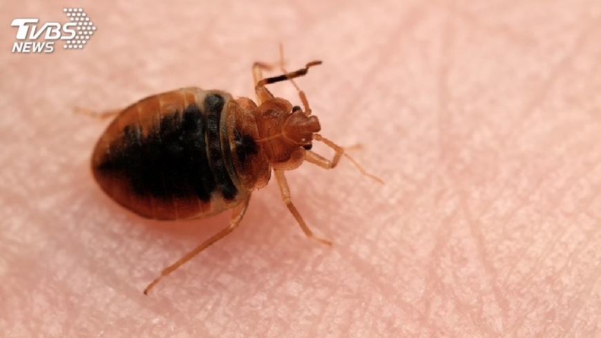 衰！男搭商務艙變「紅豆冰」　床蝨狂咬150包超癢