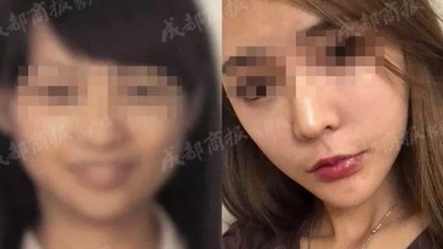 系統無法辨識!整完差太大 女登機遭拒