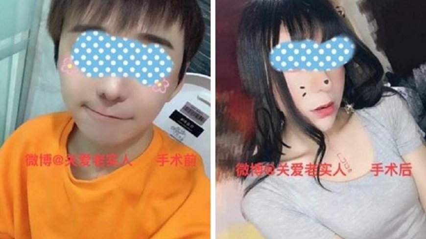 為愛變性成萌娘！鮮肉瞞家人做手術　術後被劈腿崩潰