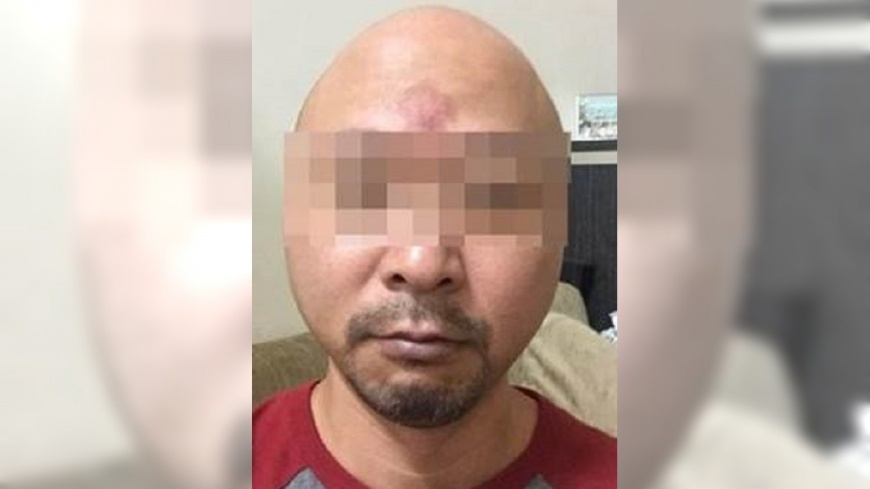老闆沒有頭髮,因此不接受退費。(圖/翻攝自爆料公社)