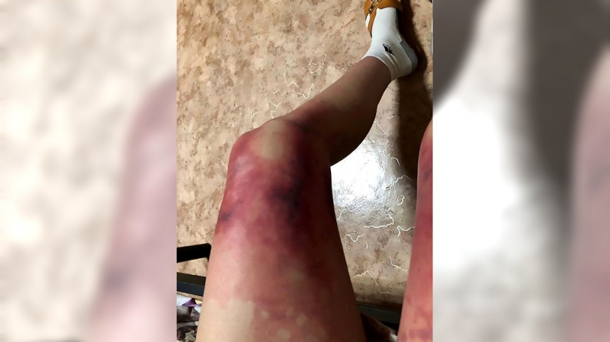 就是要辣!女大生-40度硬穿短裙 美腿凍傷發紫