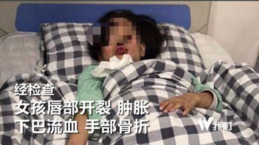小男孩丟鞭炮進化糞池 人孔蓋噴飛砸傷小女孩