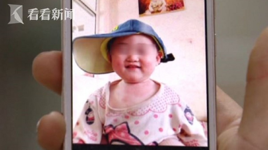 1歲女墜鍋「滾水烹煮」！傻爺急救孫　脫衣扯爛整副人皮