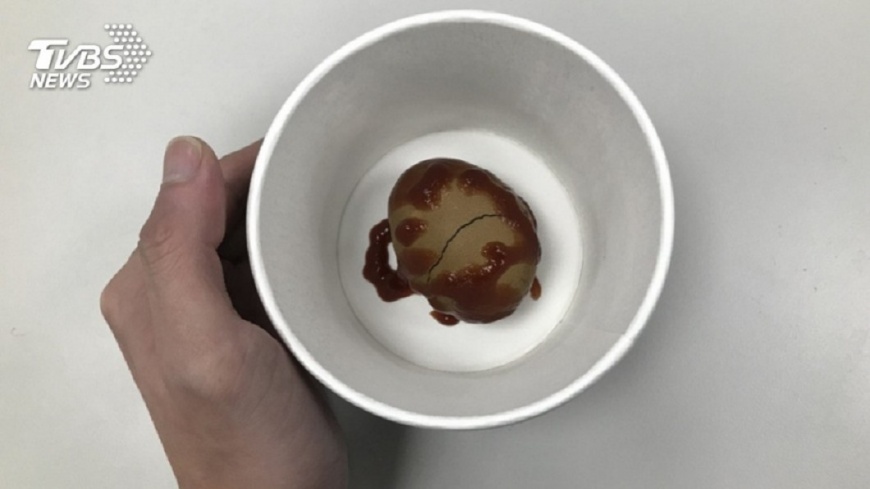騎車夾到蛋!少年忍3天 那顆發黑「扭360度」只好切