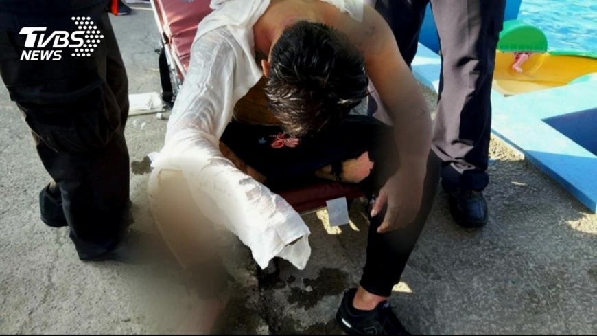 出遊驚魂!內灣「卡丁車」燒 男50%二度燙傷