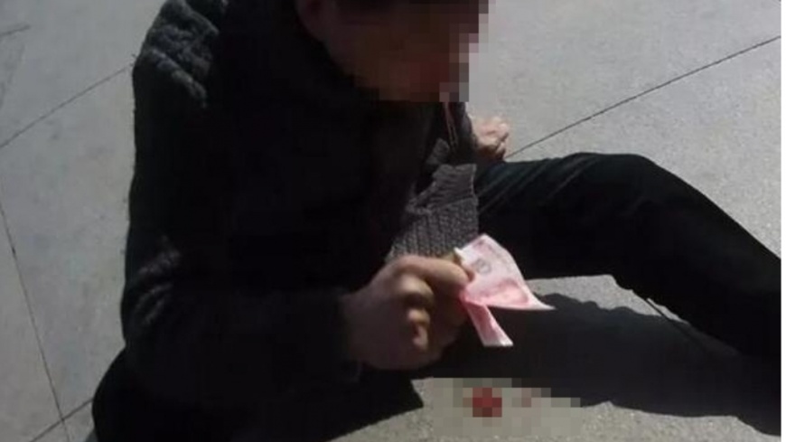 男心臟病突發倒地沒人理 撒鈔票引注意求援