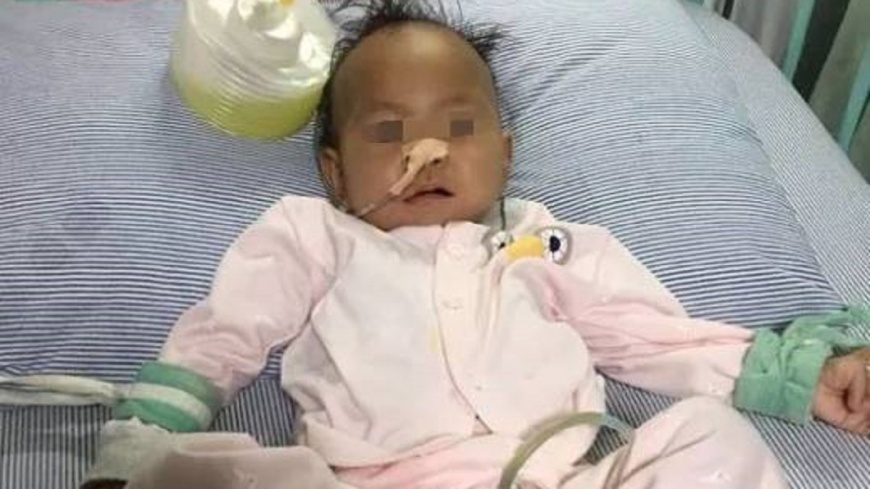 新手爸媽餵大量玉米 1歲嬰「胃撐爆」險沒命!