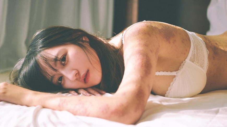 網紅患病接廣告嘆「哭著也要笑」 她怒轟:當我們傻子?