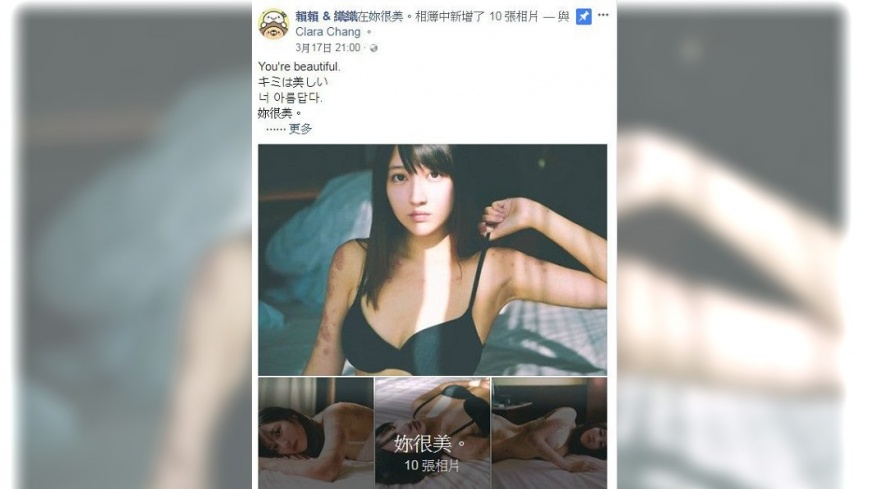 織織罹病接內衣廣告,挨轟裝窮。圖/賴賴&織織臉書
