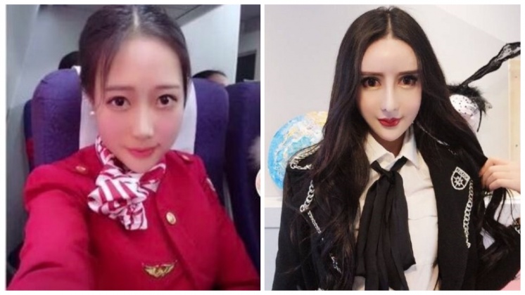 打工只為整形！　塑膠網紅自豪：整了變勝利組