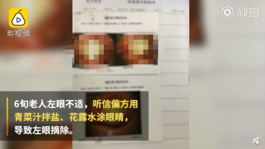 圖/翻攝自秒拍