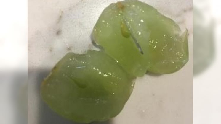 澳洲水果藏針事件再現! 女童險被割破嘴