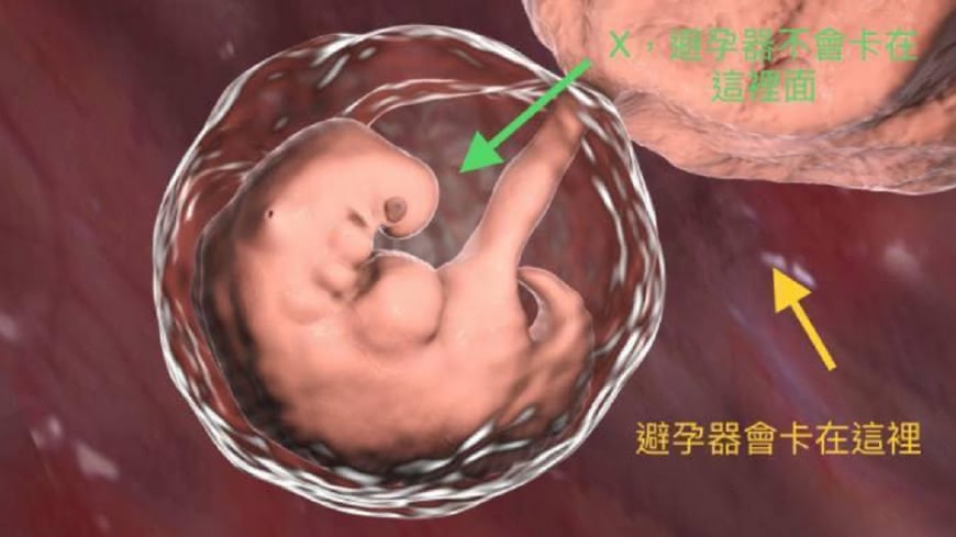 圖/蘇怡寧醫師授權提供