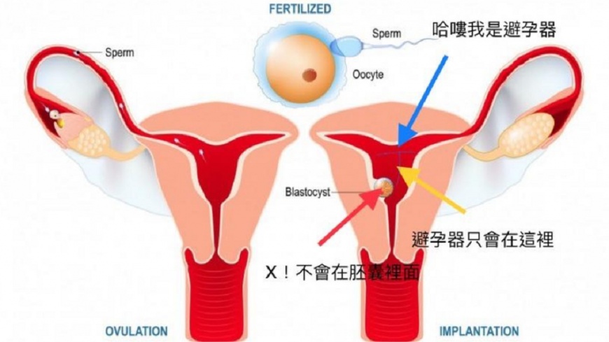 圖/蘇怡寧醫師授權提供