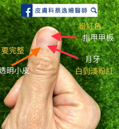圖/皮膚科醫師蔡逸姍授權提供