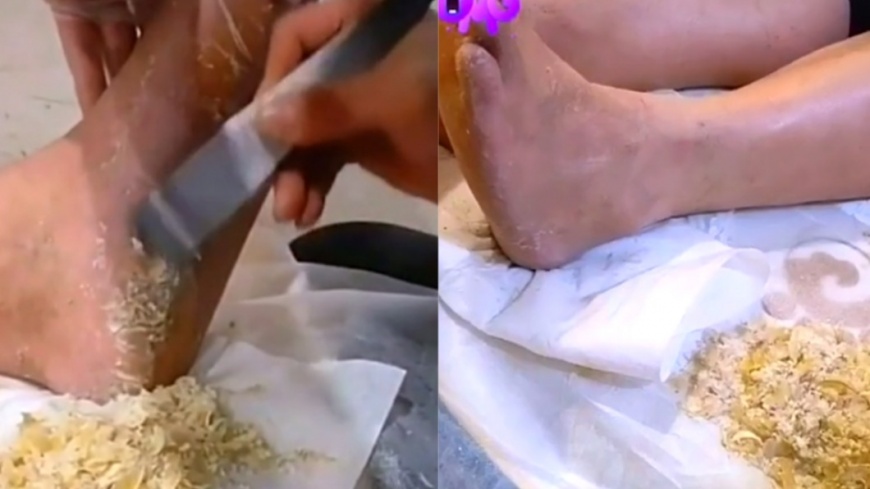 腳皮堆積成一座小山。（圖／翻攝自minke328 TikTok）