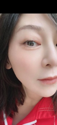 王彩樺長針眼。(圖/翻攝自王彩樺臉書)