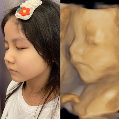 寶貝女兒與尚未出世的兒子側臉幾乎100%相似。(圖/翻攝自那對夫妻臉書)