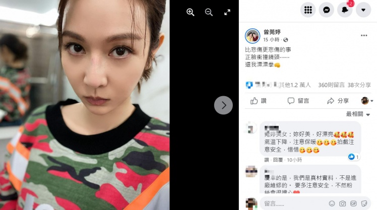 曾莞婷在臉書PO上「鼻樑受傷」的照片。(圖/翻攝自曾莞婷臉書)