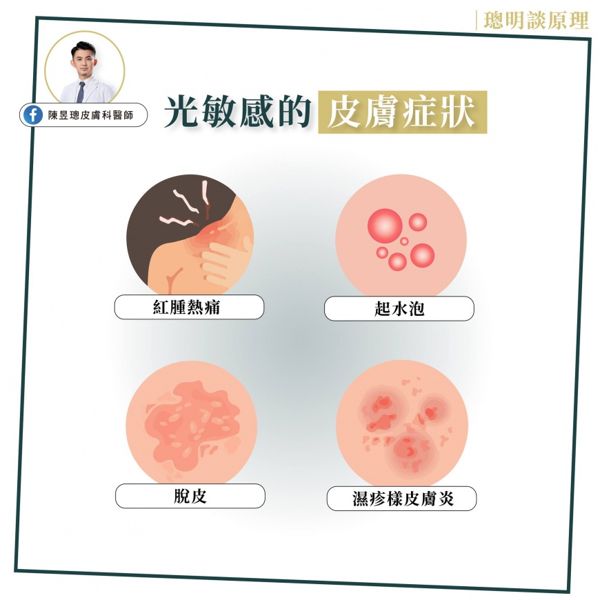 光敏感的皮膚症狀。(圖/翻攝自陳昱璁皮膚科醫師臉書)