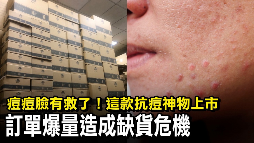 痘痘肌有解！台酒抗痘神物太強爆供貨危機