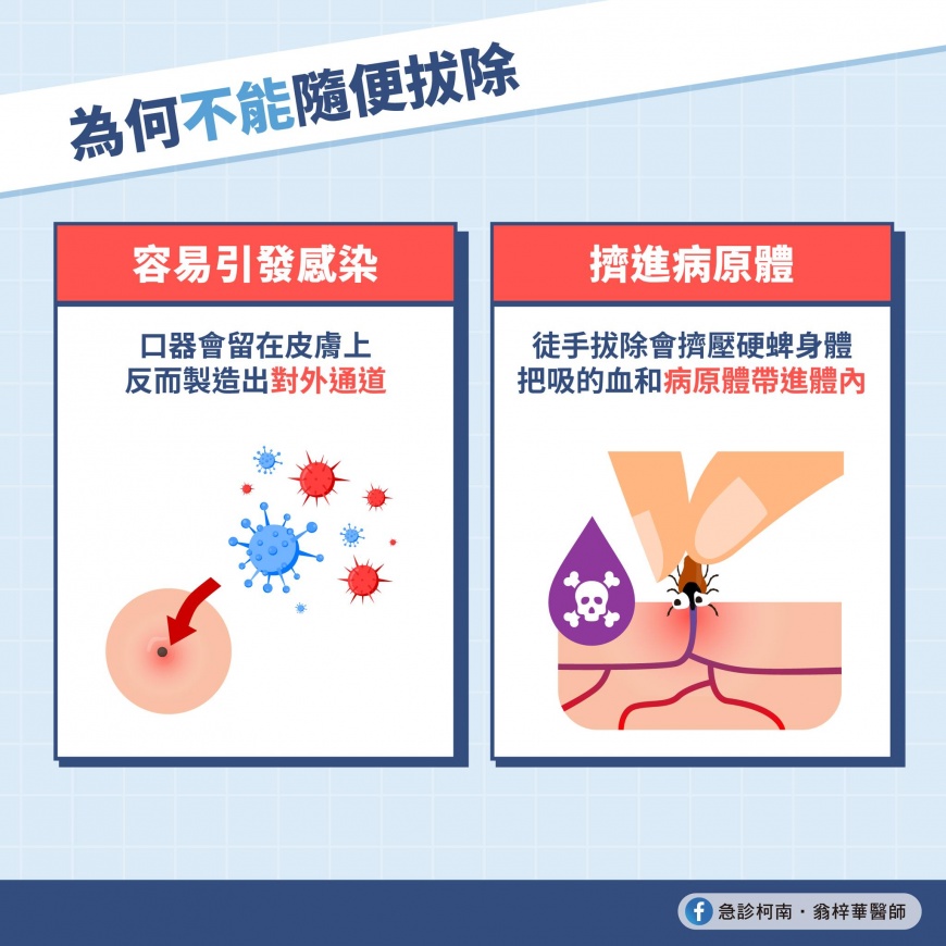 翁梓華醫師解釋不能用手拔的原因。(圖/翻攝自@急診柯南.翁梓華醫師 臉書)