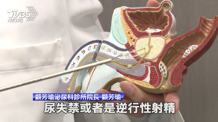 傳統手術容易伴隨尿失禁或是逆行性射精的問題。