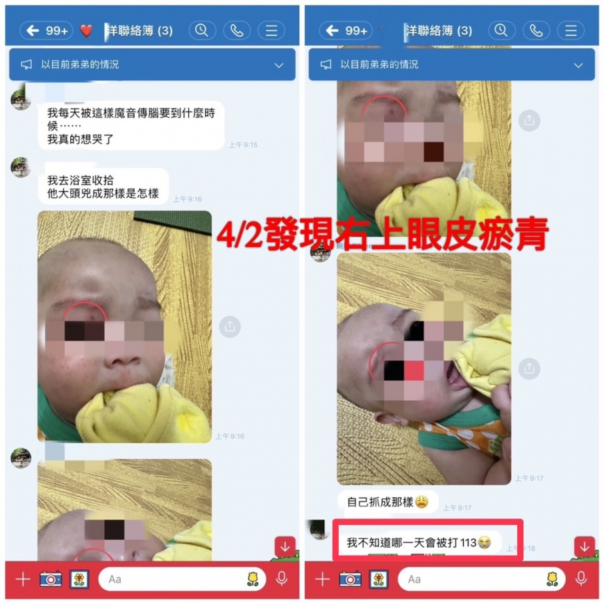 保母拍照回傳瘀青傷勢。(圖/家長提供)