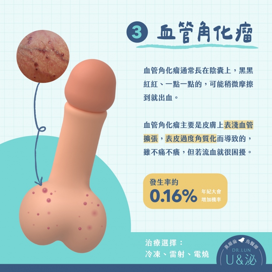 血管角化瘤。(圖/翻攝「U and泌的鳥醫師.黃維倫」)