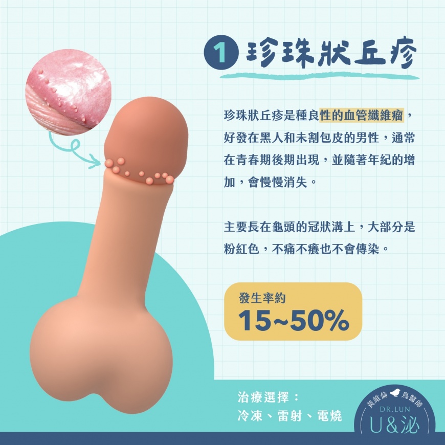 珍珠狀丘疹。(圖/翻攝「U and泌的鳥醫師.黃維倫」)