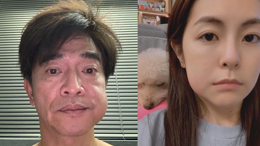 藝人吳宗憲和任容萱,先前都曾在臉書貼出拔牙後的臉腫照。(圖/翻攝自吳宗憲、任容萱臉書)