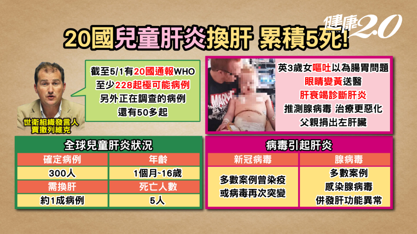 20國兒童肝炎換肝，累積5死。（圖／健康2.0）