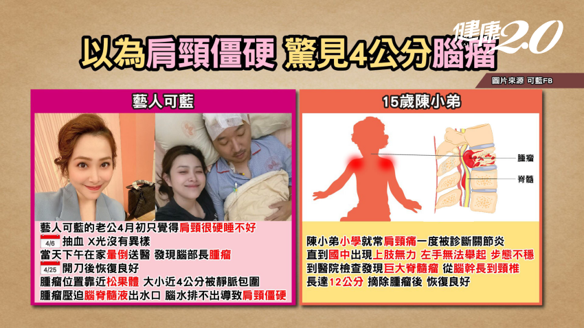 肩頸痠痛結果是腦瘤。(圖/TVBS《健康2.0》)