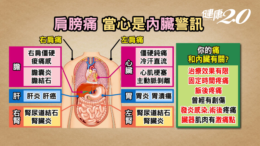 肩膀痛當心是內臟警訊。(圖/TVBS《健康2.0》)
