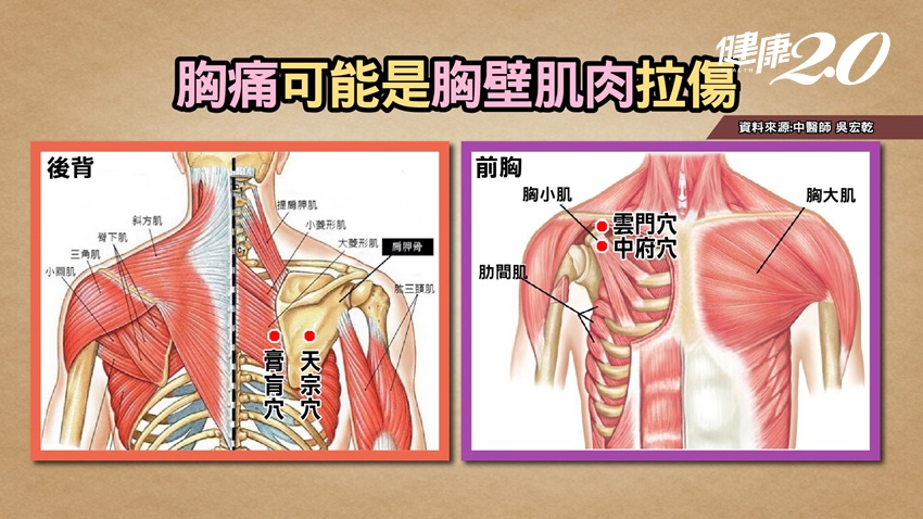 胸痛可能是胸壁肌肉拉傷。(圖/健康2.0)