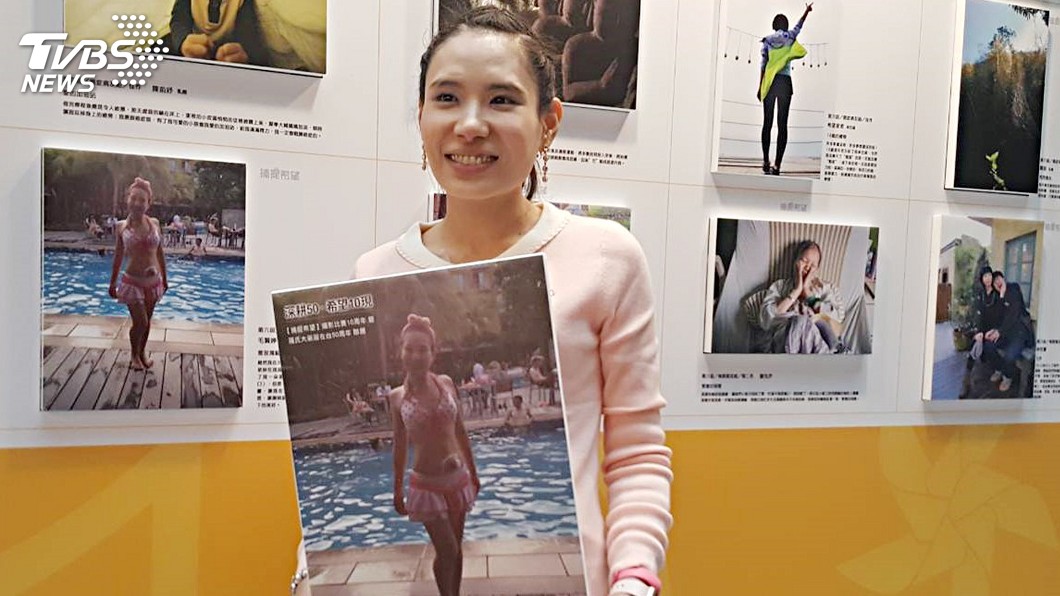 不畏切肛門掛便袋　抗癌正妹如花芬芳